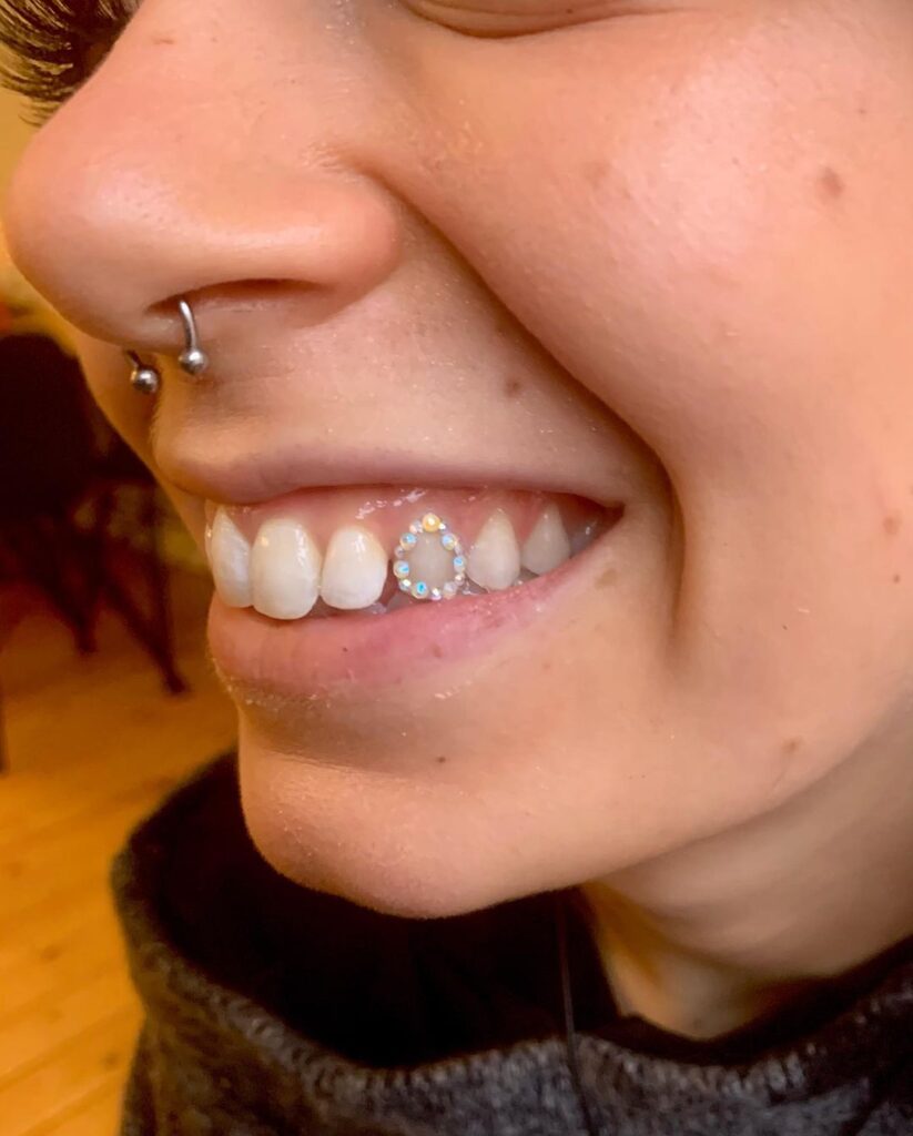 Griglia Del Radiatore Parte Inferiore E Parti Superiori Fiat 124 Spider Bs Cs 69 78 - Foto 2