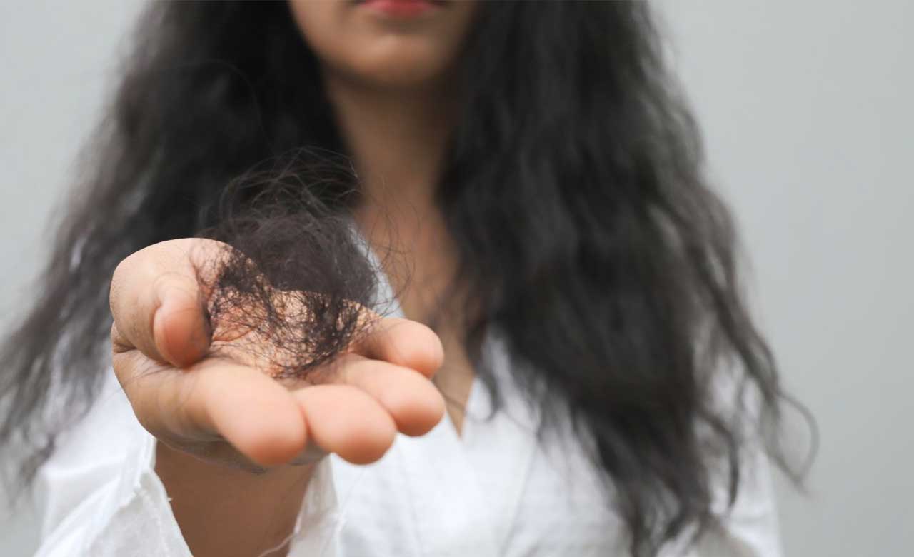 Cause del diradamento dei capelli nelle donne Cause del diradamento dei capelli nelle donne